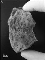 Tethya crassispicula Holotype