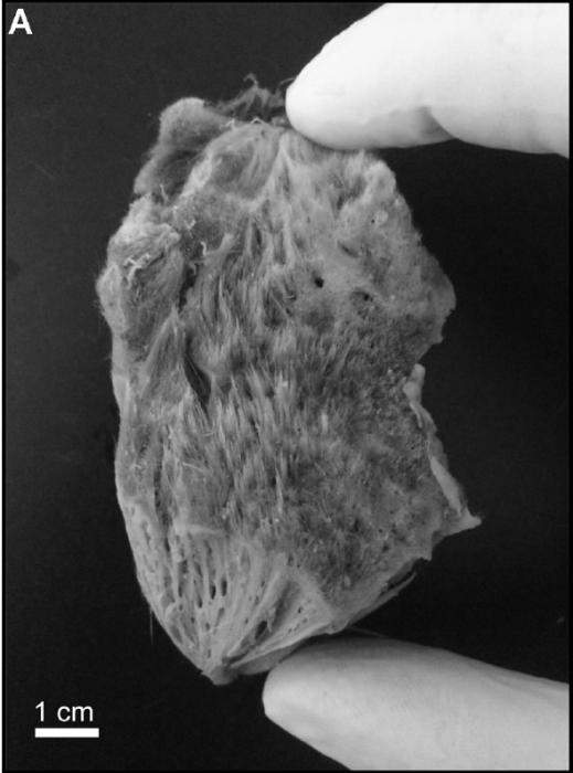 Tethya crassispicula Holotype