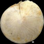 Amphistegina mammilla (Fichtel & Moll, 1798)