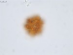 Pollen grain of Vernonia andapensis, H. Humbert, R. Capuron, 21940