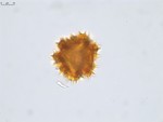 Pollen grain of Vernonia andapensis, H. Humbert, R. Capuron, 21940