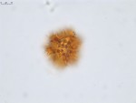 Pollen grain of Vernonia andapensis, H. Humbert, R. Capuron, 21940