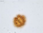 Pollen grain of Vernonia andapensis, H. Humbert, R. Capuron, 21940