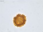 Pollen grain of Vernonia andapensis, H. Humbert, R. Capuron, 21940