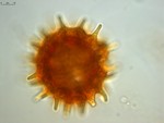 Pollen grain of Vernonia baillonii, Antilahimena, P., 4899