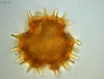 Pollen grain of Vernonia baillonii, Antilahimena, P., 4899
