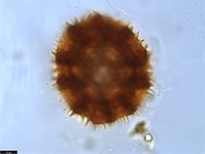 Pollen grain of Vernonia britteniana, Bamps, P., 4004