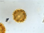 Pollen grain of Vernonia ikongensis, R. Decary, 5530
