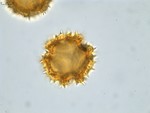 Pollen grain of Vernonia ikongensis, R. Decary, 5530
