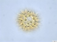 Pollen grain of Vernonia lisowskii, Durigneaud, 4557