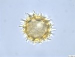 Pollen grain of Vernonia lisowskii, Durigneaud, 4557