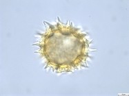 Pollen grain of Vernonia lisowskii, Durigneaud, 4557
