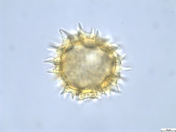 Pollen grain of Vernonia lisowskii, Durigneaud, 4557
