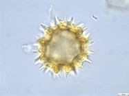 Pollen grain of Vernonia lisowskii, Durigneaud, 4557