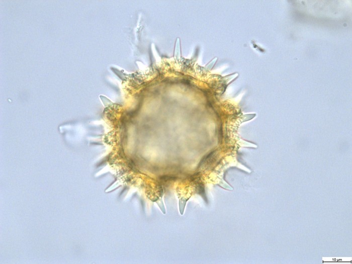 Pollen grain of Vernonia lisowskii, Durigneaud, 4557