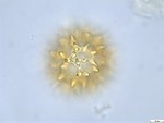 Pollen grain of Vernonia lisowskii, Durigneaud, 4557