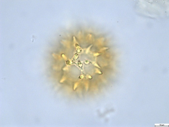 Pollen grain of Vernonia lisowskii, Durigneaud, 4557