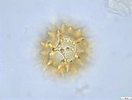 Pollen grain of Vernonia lisowskii, Durigneaud, 4557