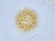 Pollen grain of Vernonia lisowskii, Durigneaud, 4557