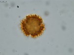 Pollen grain of Vernonia neocoursiana, G. Cours, 4700