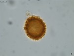 Pollen grain of Vernonia neocoursiana, G. Cours, 4700
