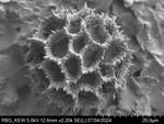 Pollen grain of Vernonia rhodophylla, Welwitsch, 3340