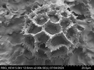 Pollen grain of Vernonia rhodophylla, Welwitsch, 3340