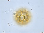 Pollen grain of Vernonia rubens, Tryer, 627