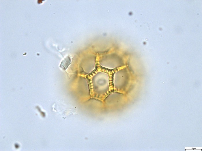 Pollen grain of Vernonia rubens, Tryer, 627