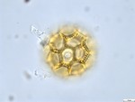 Pollen grain of Vernonia rubens, Tryer, 627