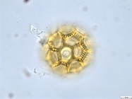 Pollen grain of Vernonia rubens, Tryer, 627