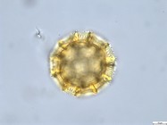 Pollen grain of Vernonia rubens, Tryer, 627
