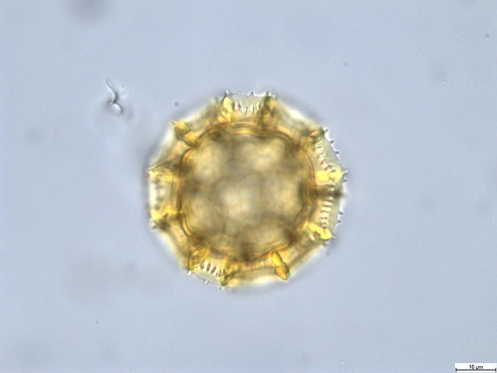 Pollen grain of Vernonia rubens, Tryer, 627