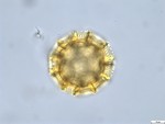 Pollen grain of Vernonia rubens, Tryer, 627