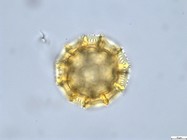 Pollen grain of Vernonia rubens, Tryer, 627