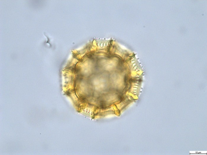 Pollen grain of Vernonia rubens, Tryer, 627