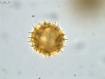 Pollen grain of Vernonia sakalava, H. Perrier de la Bâthie, 1448