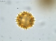 Pollen grain of Vernonia sakalava, H. Perrier de la Bâthie, 1448