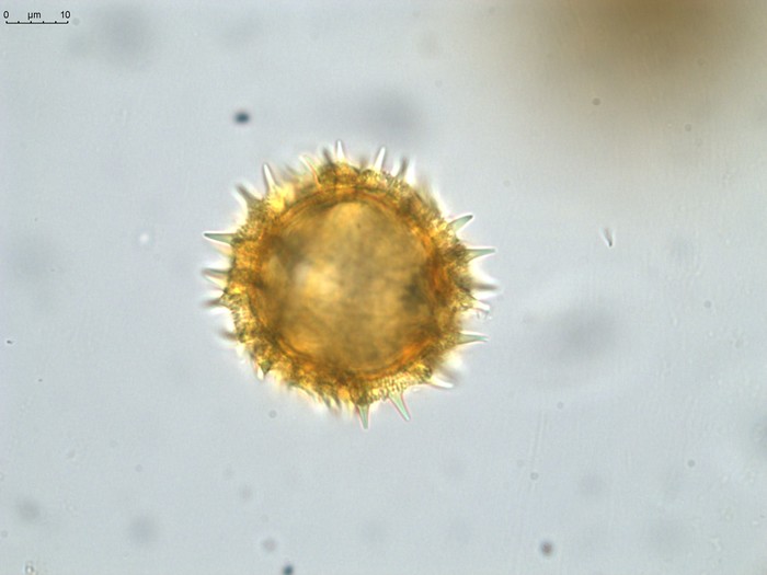 Pollen grain of Vernonia sakalava, H. Perrier de la Bâthie, 1448