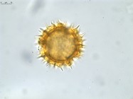Pollen grain of Vernonia sakalava, H. Perrier de la Bâthie, 1448