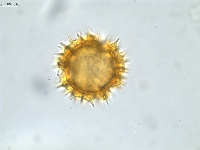 Pollen grain of Vernonia sakalava, H. Perrier de la Bâthie, 1448