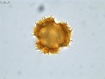 Pollen grain of Vernonia sambiranensis, H. Perrier de la Bathie, 3209