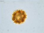 Pollen grain of Vernonia sambiranensis, H. Perrier de la Bathie, 3209