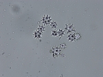 Aurora actinosa Oxyspherasters of holotype