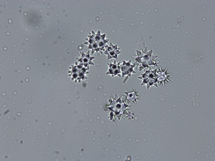 Aurora actinosa Oxyspherasters of holotype