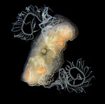 Vallicula multiformis, apical view