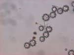 Spicules of holotype