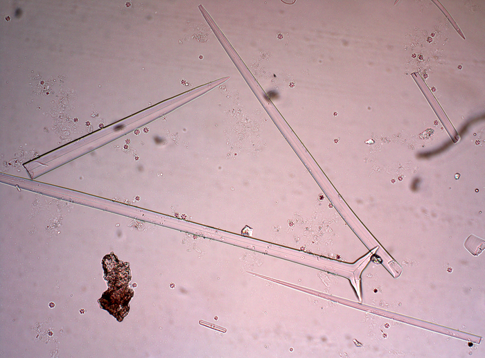 Holotype spicules