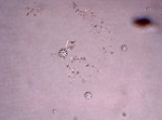 Holotype spicule