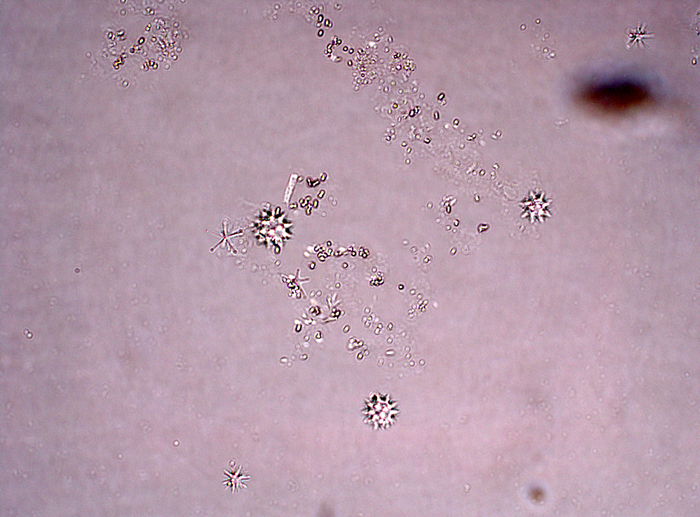 Holotype spicule